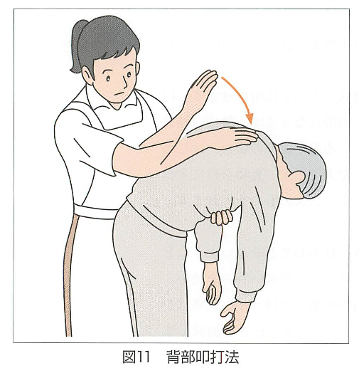(ပုံ 11)