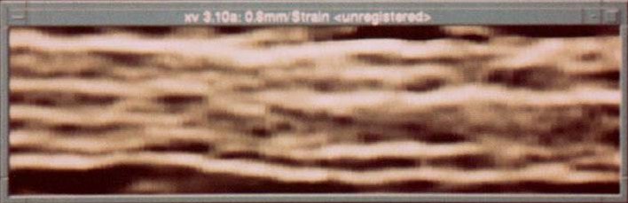 In vitro pork rib, Strain image, Elastography